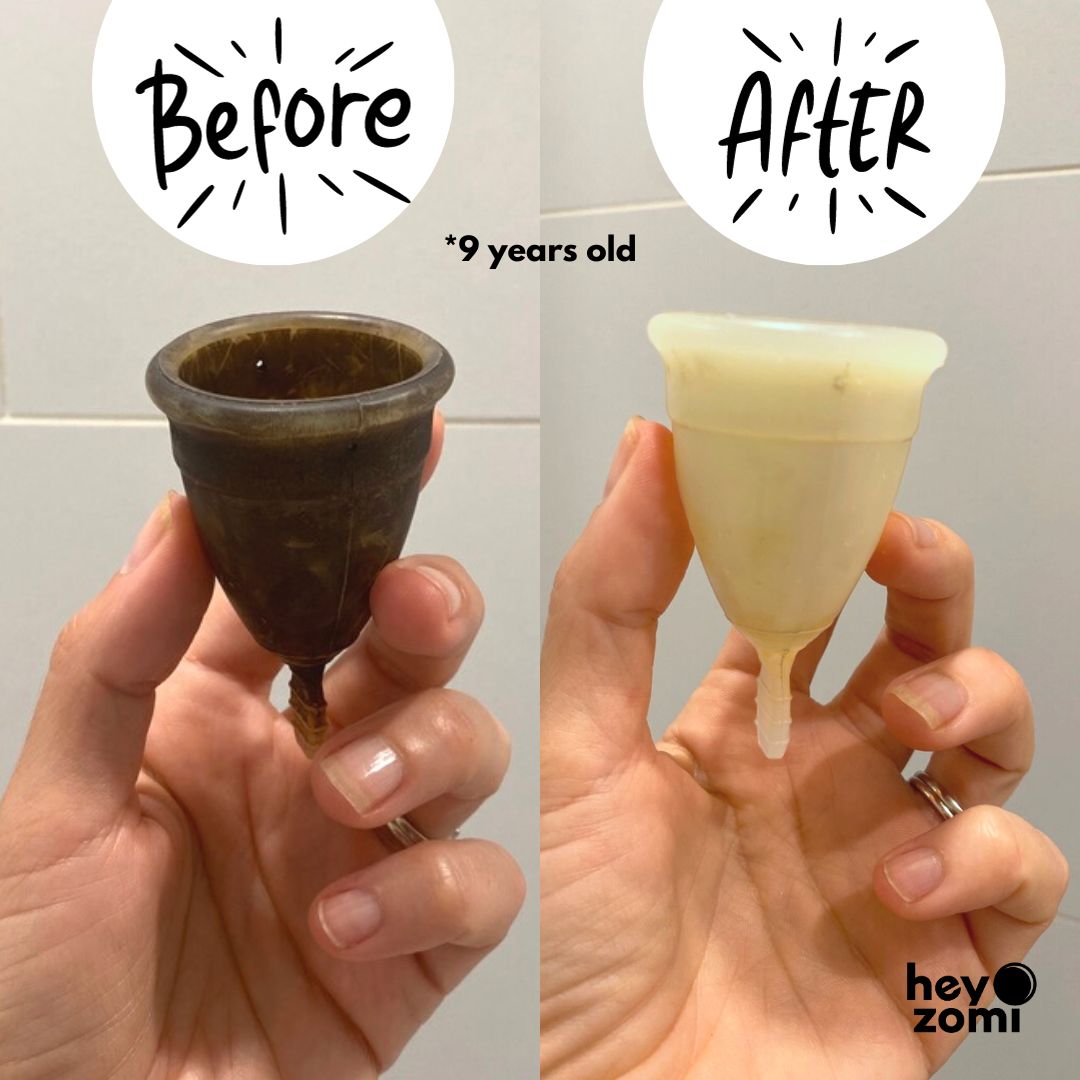
                  
                    Stained menstrual cup? Restore it to new with the Hey Zomi cleaning tablets
                  
                